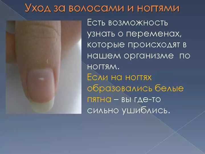 Уход за кожей волосами ногтями. Заболевания ногтей на руках таблица. Памятка по гигиене кожи волос ногтей. Памятка по уходу за ногтями и волосами. Памятка по уходу за кожей и ногтями.