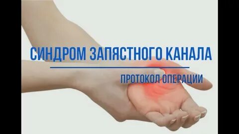 Операция канал
