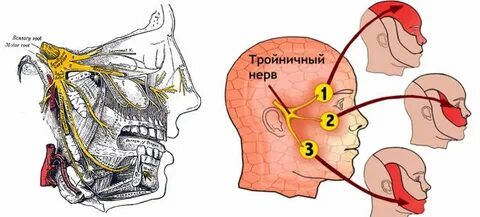 Дарсонваль тройничный нерв