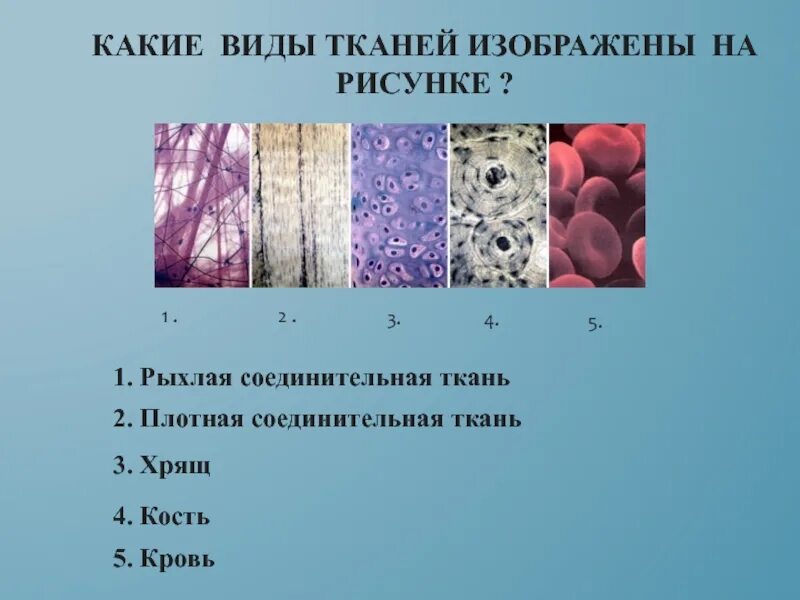 Какому типу ткани относится. Виды тканей. Типы соединительной ткани человека. Изображена соединительная ткань. Соединительная ткань биология 8 класс.