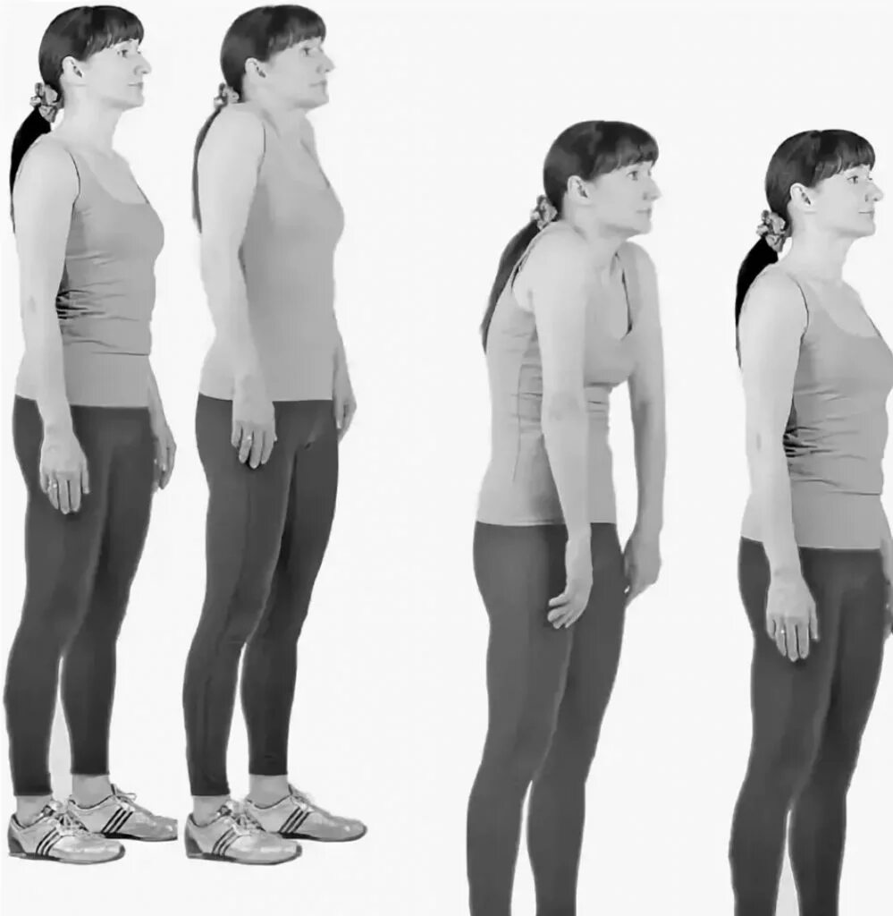 Комплекс упражнений для спины при остеохондрозе поясничного отдела. Эргономика и биомеханика. Упражнения при остеохондрозе поясничного отдела позвоночника. Походка при остеохондрозе. Походка при остеохондрозе.