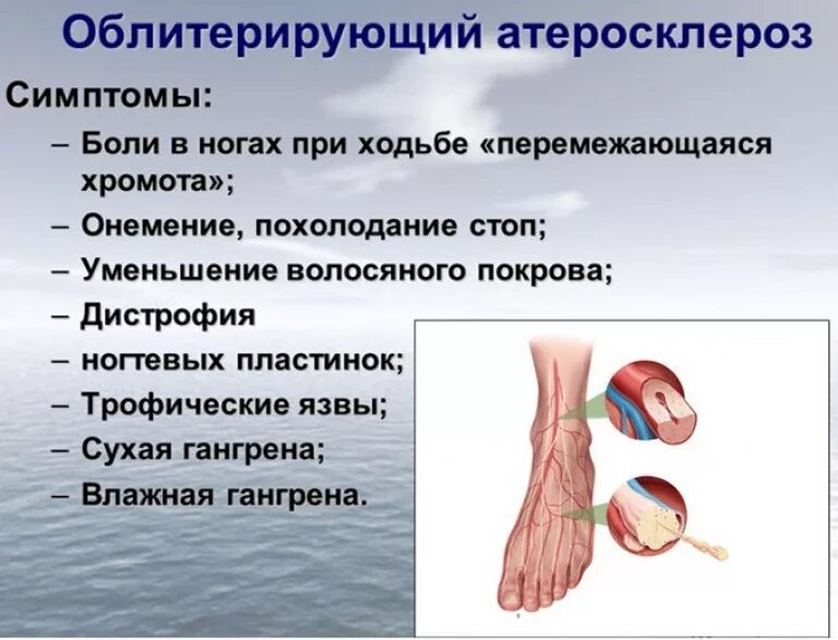 Хроническая окклюзия артерий нижних конечностей. Сосуды нижних конечностей. Облитерирующий атеросклероз артерий нижних конечностей. Диаметр вен нижних конечностей. Атеросклероз сосудов нижних конечностей по стадиям.