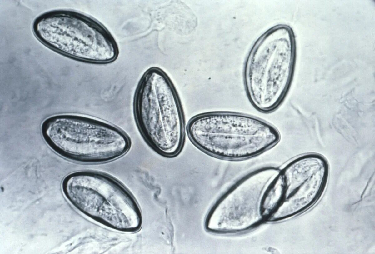 File:Enterobius vermicularis (01).tif Wikipedia