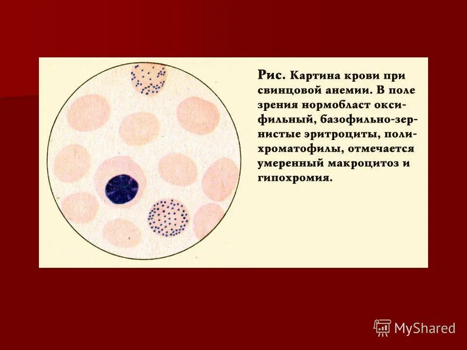 Эритроциты 0 1 в поле зрения