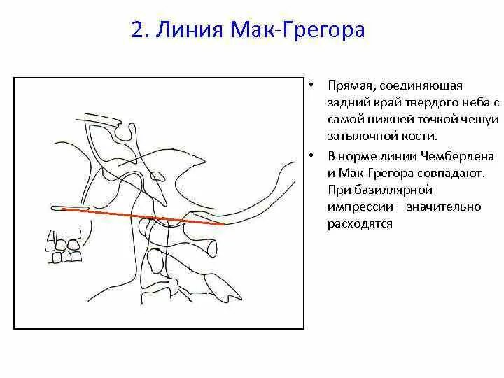 Линия мак рея
