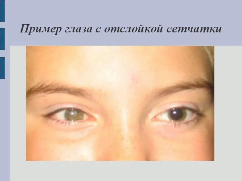 Цвета отека