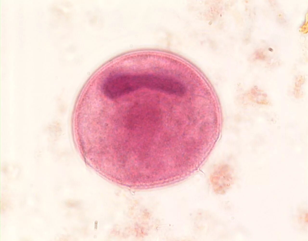 Инфузория балантидий. Balantidium coli. Инфузория балантидий жизненный цикл. Balantidium coli. Вегетативная форма balantidium coli.