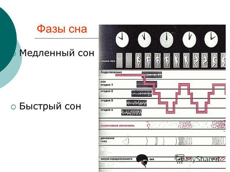 2 фазы сна медленный и быстрый. Фазы сна. быстрый и медленный сон.