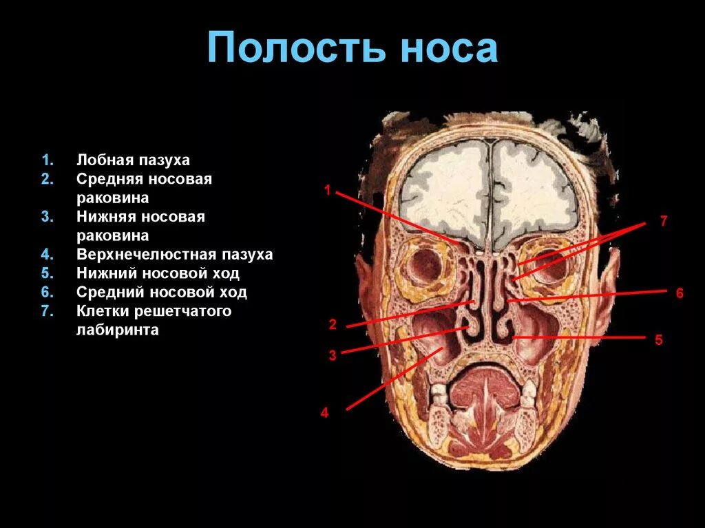 Полости в костях черепа. Околоносовые пазухи черепа. Строение черепа носовые пазухи. Строение черепа лобная пазуха. Лобные пазух черепа анатомия.