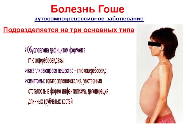 Синдром гоше тип наследования. Вприв таблетки. Болезнь гоше 1 типа клинические проявления. Болезнь гоше наследственность. Болезнь гоше препараты.