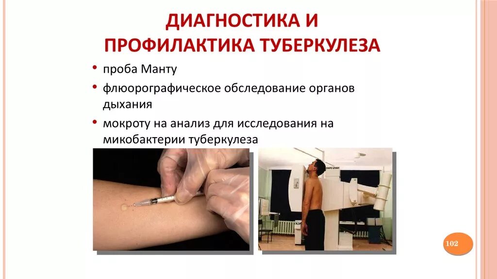 диагностика туберкулеза презентация. пробы для диагностики туберкулеза. диагностические туберкулиновые пробы. пробы для диагностики туберкулеза. метод профилактического выявление туберкулеза у детей.