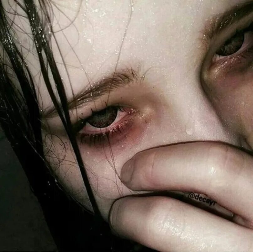 Подросток плачет. Девушка плачет. Красные заплаканные глаза. Слезы боль. Заплаканная вид
