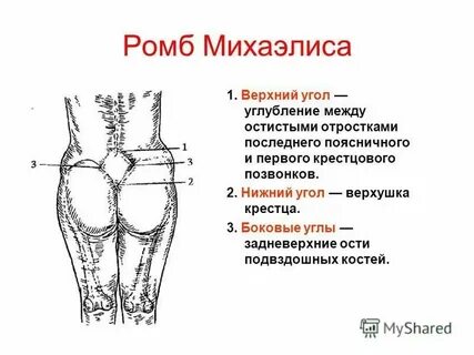 Ромб михаэлиса размеры
