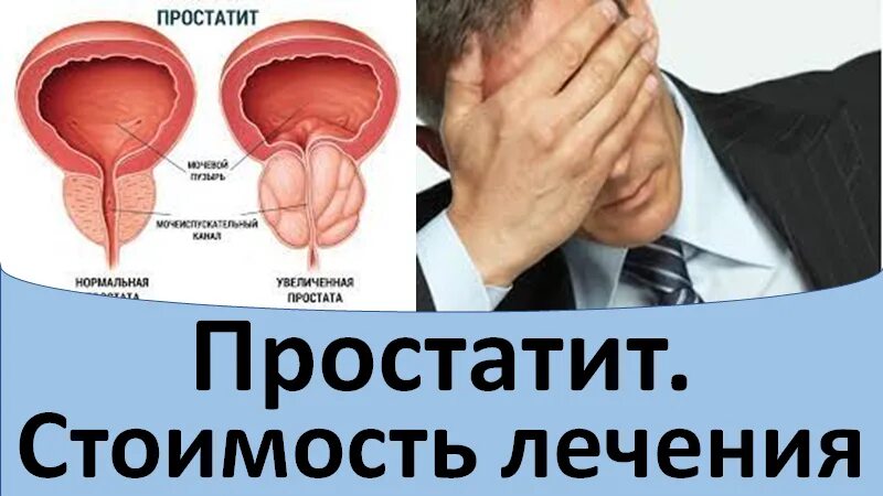 Простатит ру. Простатит клиника. Проявления простатита. Диагностика простатита.