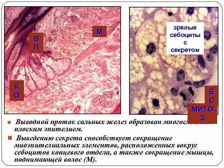 Кариопикноз это. Миоэпителиальные клетки желез кожи являются производными…. Гистофизиология ретикулярной ткани. Сальная железа эпителий гистология себоциты.