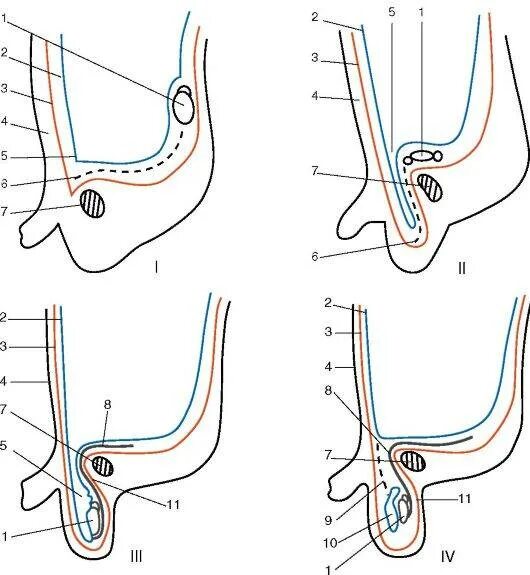 Опущение яичка анатомия. Крипторхизм эмбриогенез. Этапы опускания яичка. Процесс опускания яичка анатомия. Не опускаются яички что делать