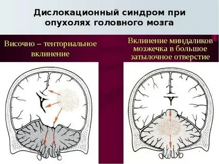 Клиническая головного мозга