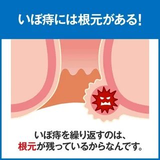 Amazon (第 2 類 医 薬 品)ヘ モ リ ン ド 20 錠 小 林 製 薬 痔 