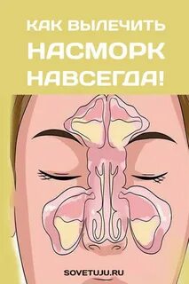 Как не быть соплей
