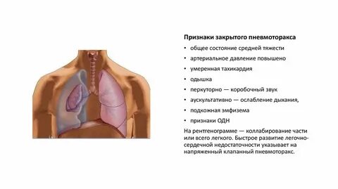 Клинические проявления клапанного пневмоторакса