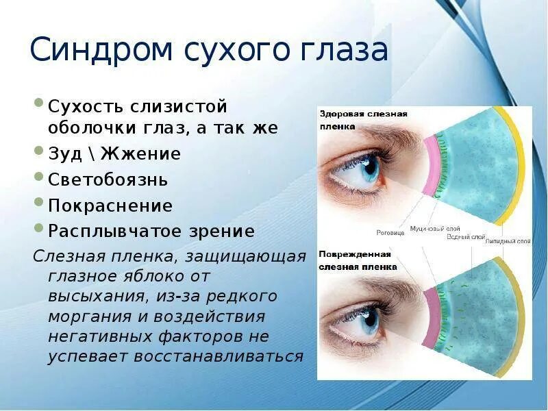 Синдром сухого глаза причины. Синдром сухого глаза покраснение. Синдром сухого глаза покраснение глаз.
