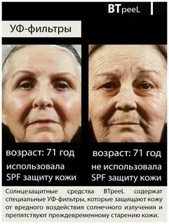 Как солнце влияет на кожу
