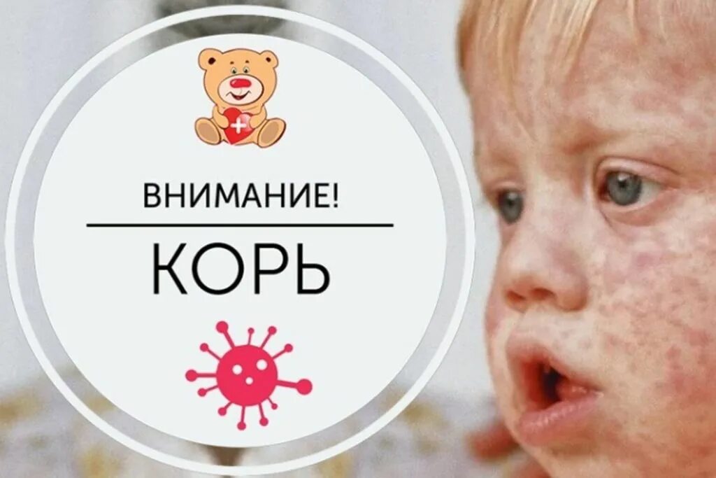 Памятка по профилактике кори. Сайт кори. Сайт кори. Gfvznrf ghj rjhm. Сайт кори.