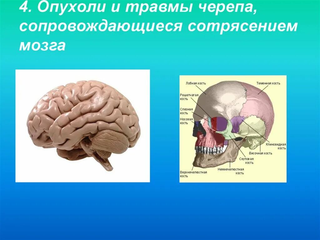 Слайд множественные травмы черепа. Физическая травма черепа. Травмы черепа и головного мозга