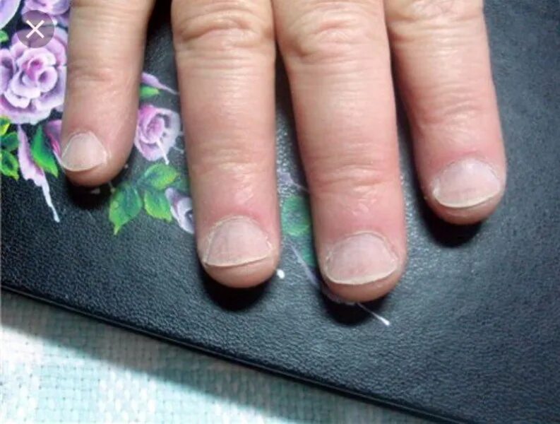 Опил формы ногтей миндаль. Опил ногтей миндаль. Маникюр на короткие широкие ногти. Маникюр на короткие ногти, который визуально удлиняет пластину. Как сделать ногти широкими.