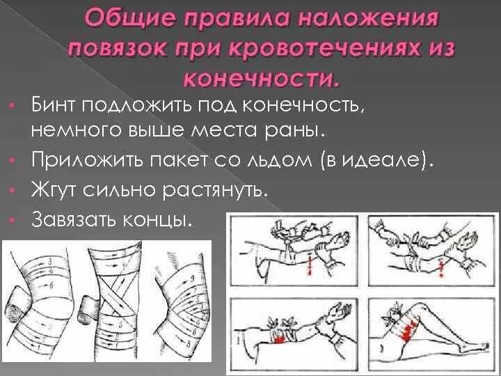 Бинтовая повязка алгоритм. При наложении повязки бинтование осуществляют. Правила наложения повязок на конечности. При наложении повязки на конечность, бинтование осуществляют:. Правило наложение повязок.