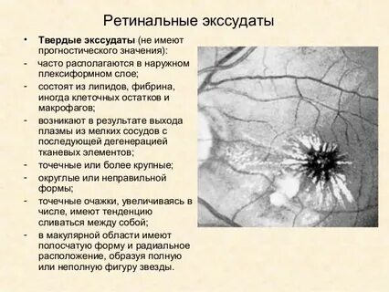 Ретинальные сосудистые изменения