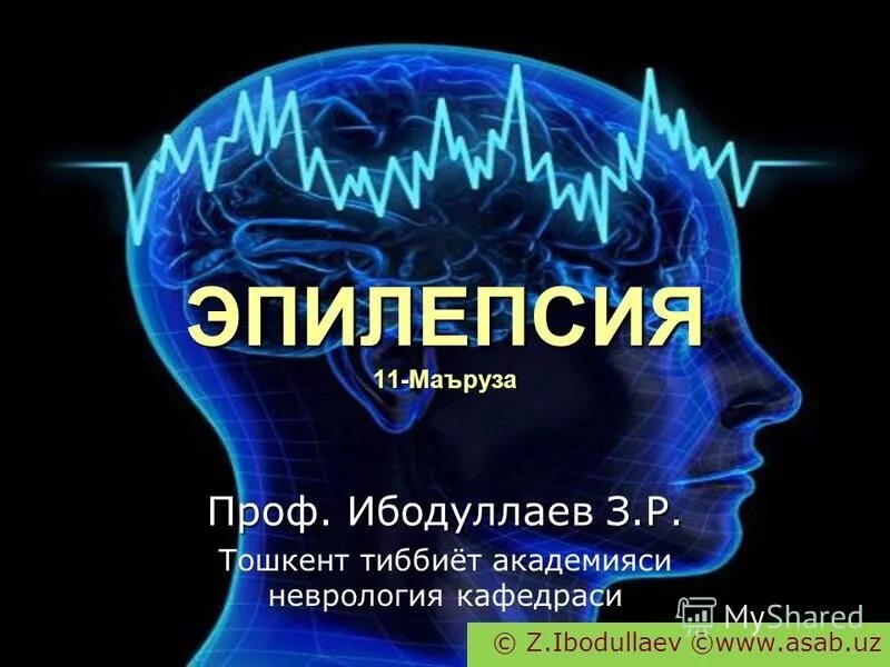 Невролог эпилепсия. Эпилепсия неврология. Эпилепсия лекция. Эпилепсия лекция по неврологии. Диагностика эпилепсии неврология.