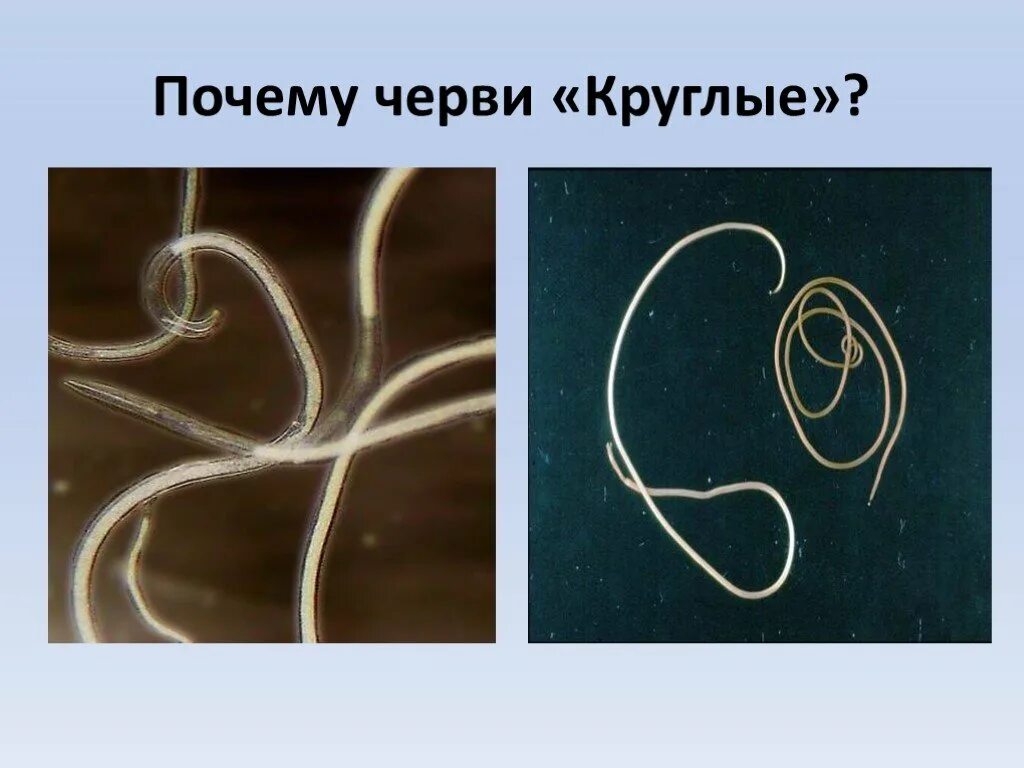 круглые гельминты,нематоды. человеческие черви аскариды паразитические. круглые аскариды. круглые черви аскарида человеческая. круглые аскариды.