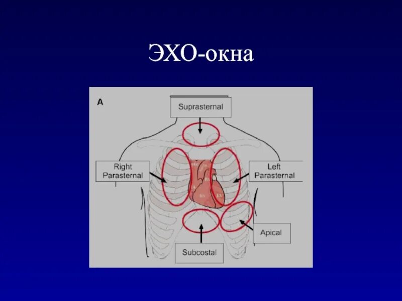 Эхо гостомеля. Неблагоприятное Эхо окно что такое. Транстемпоральное окно. Субокципитальное Эхо окно неудовлетворительное что это. Акустическое окно в УЗИ сердца.