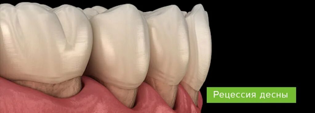 busy Shine pilot toothbrush abrasion on gums Dwell Cathedral all the best