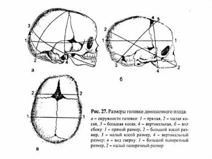 Наибольший поперечный диаметр