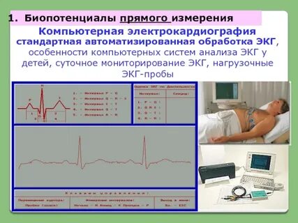 Системы экг
