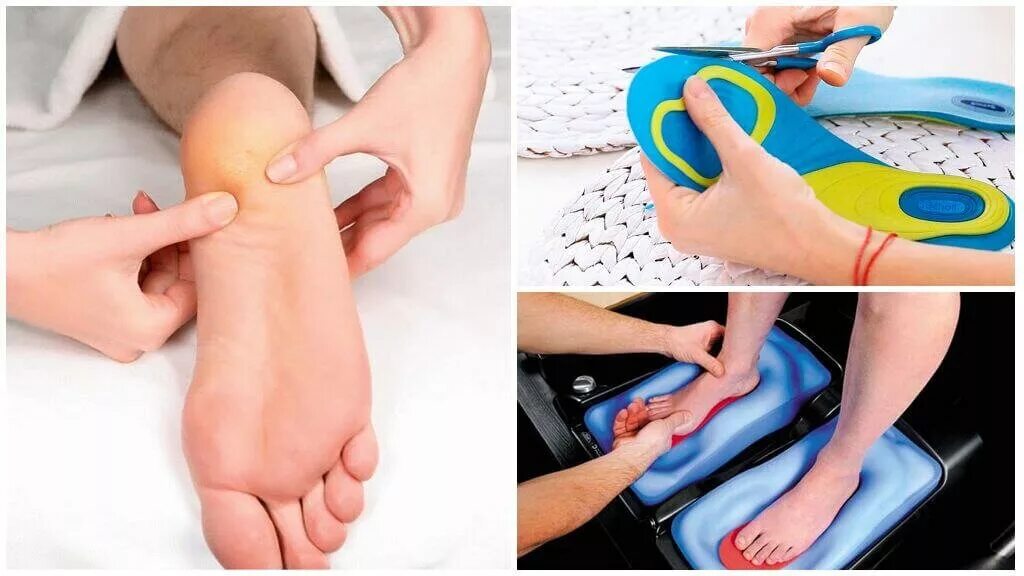 плантарный фасциит стопы лечебный массаж. лечебная гимнастика при пяточной шпоре. упражнения для стоп при лечении пяточной шпоры. стельки для пяток лечебные. лечебные массажеры при пяточной шпоре.