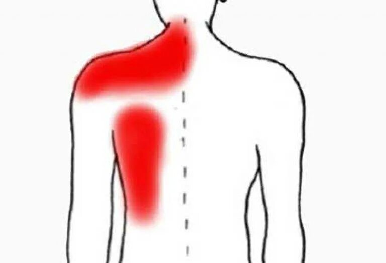 Боль под левую лопатку спины причины лечение. Боль в спине. Болит под левой лопаткой. Боль в позвоночнике между лопаток. Болит под лопаткой с левой стороны.