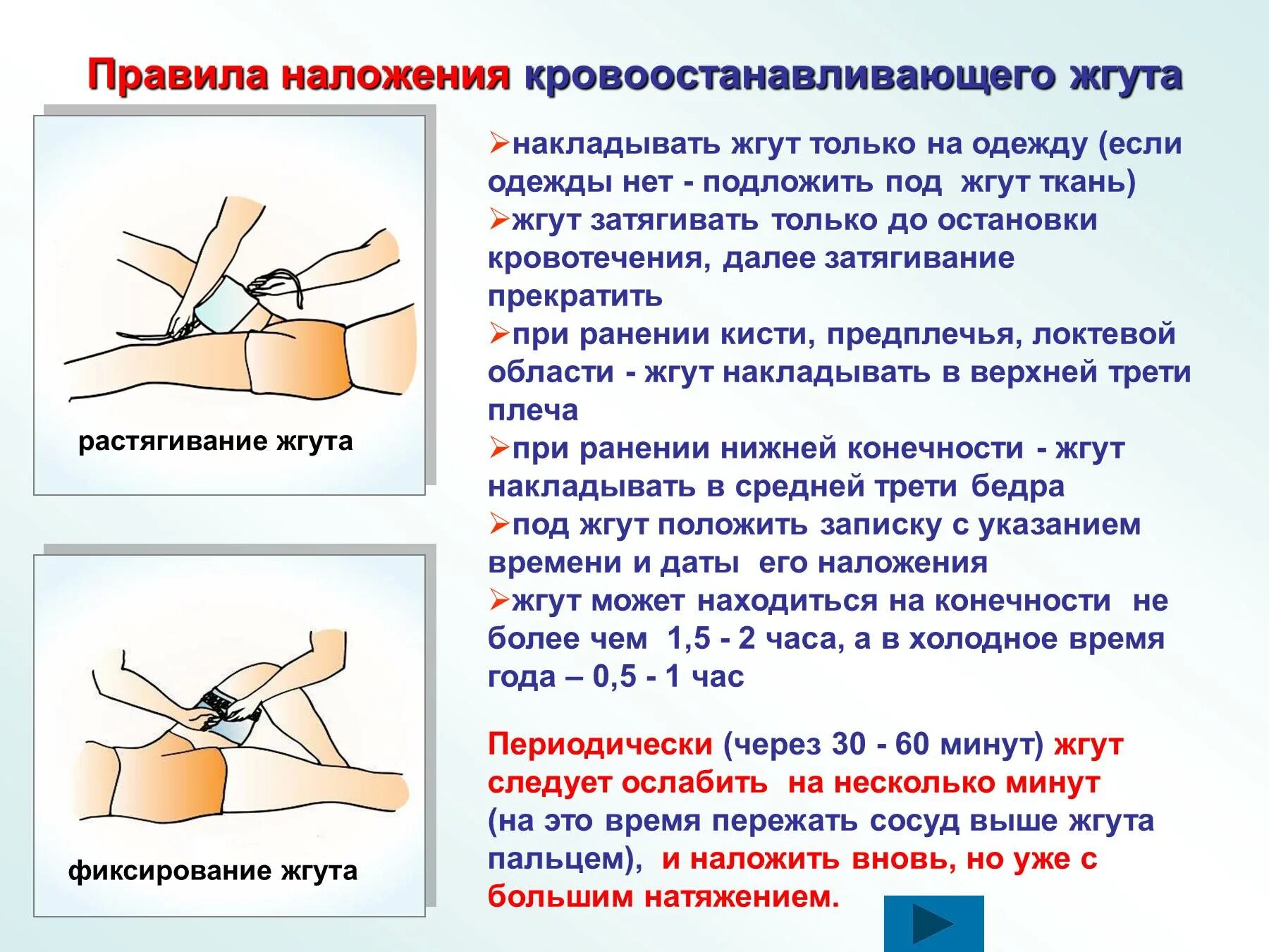 Как правильно наложить артериальный жгут. Правила наложения кровоостанавливающего жгута. Правила и время наложения кровоостанавливающего жгута. Порядок наложения жгута на конечность. На какое время можно наложить жгут на конечность при кровотечении.