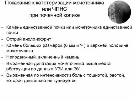 Тест нмо почечная колика