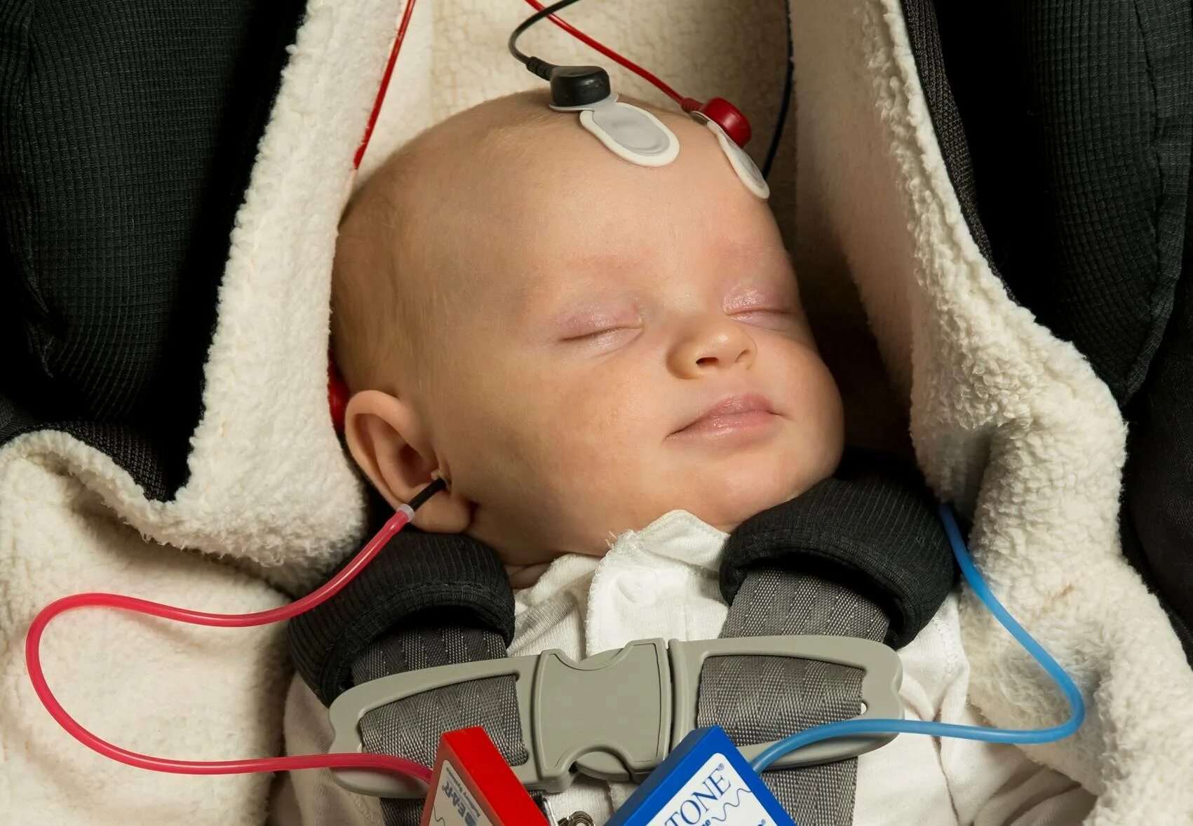Как проверить слух у новорожденного. Аудиоскрининг новорожденных. КСВП детям. Аудиометрия слуха у детей. Аппарат для проверки слуха у новорожденных.