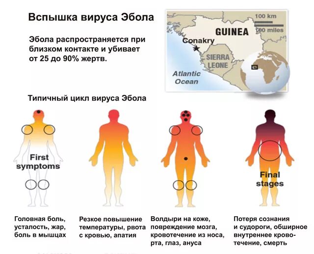 Вирус где найду. Лихорадка Эбола симптомы. Эбола пути передачи инфекции. Лихорадка Эбола пути заражения.