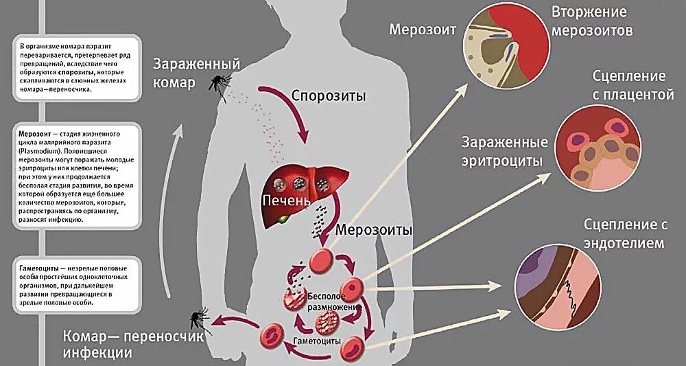 Человек при малярии является. Малярийный плазмодий это бактерия. Малярийный плазмодий заболевание. Симптомы болезни малярийного плазмодия. Симптомы заражения малярийного плазмодия.