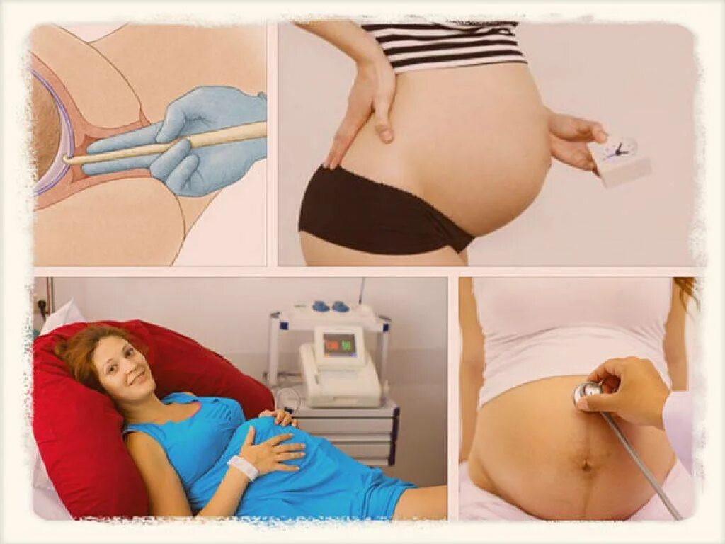 Можно ли после родов. Схватки перед родами. Прокалывают пузырь перед родами. Прокол пузыря при беременности. Беременность перед родами.