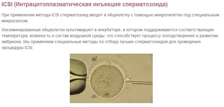 Эко икси форум. Интрацитоплазматическая инъекция сперматозоидов. интрацитоплазматическая инъекция сперматозоидов (икси). интрацитоплазматическая инъекция сперматозоида в яйцеклетку. инъекция сперматозоида в цитоплазму ооцита.