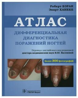 Диагностика по ногтям