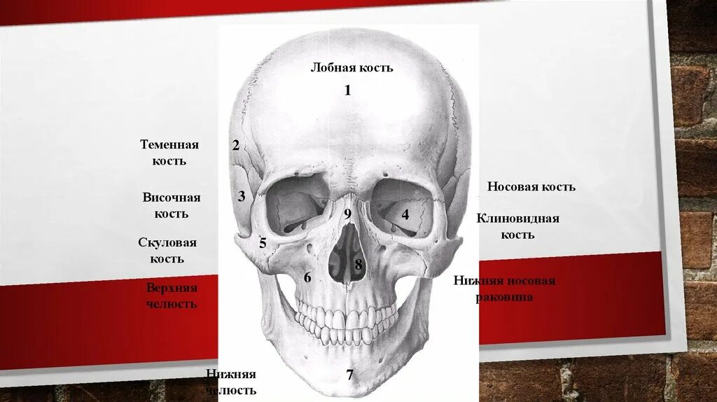 Лобная и теменная кость. Лобная кость носовая кость. Лобная и височная кость. Широкая лобная кость.