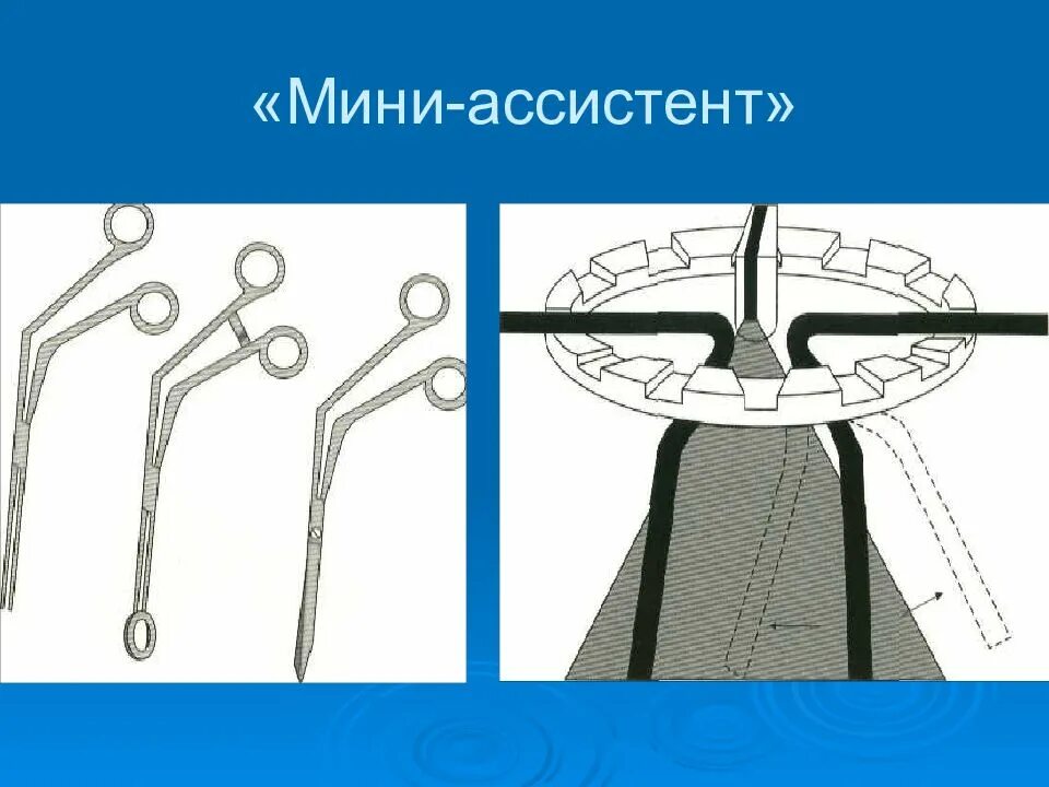 Устройство ассистента