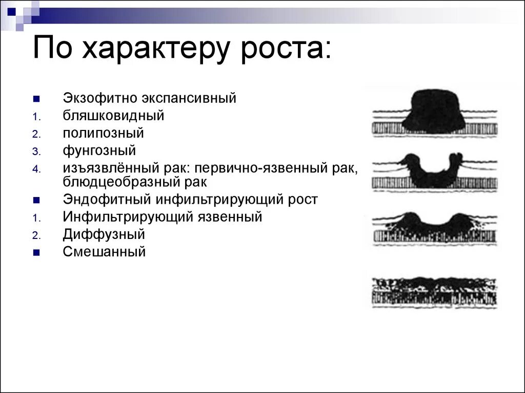 Экзофитный и эндофитный рост опухоли. Эндофитный рост опухоли рисунок. Экзофитный характер роста. Эндофитный рост опухоли